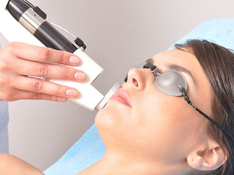 Rejuvenecimiento con láser de piel facial