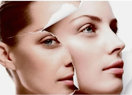 Procedimiento de rejuvenecimiento con láser facial