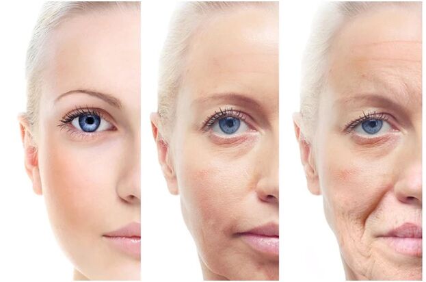 Eliminación láser de cambios faciales relacionados con la edad