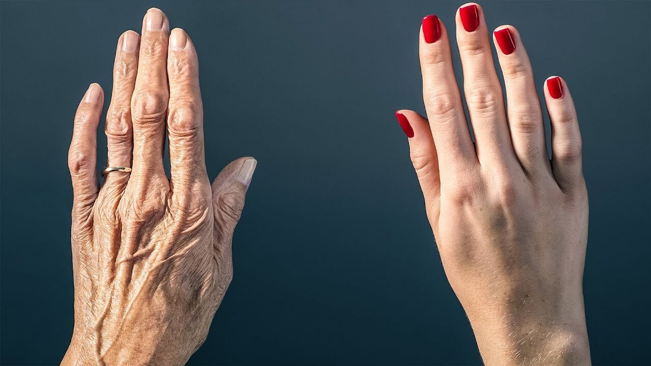 una forma eficaz de rejuvenecer la piel de las manos