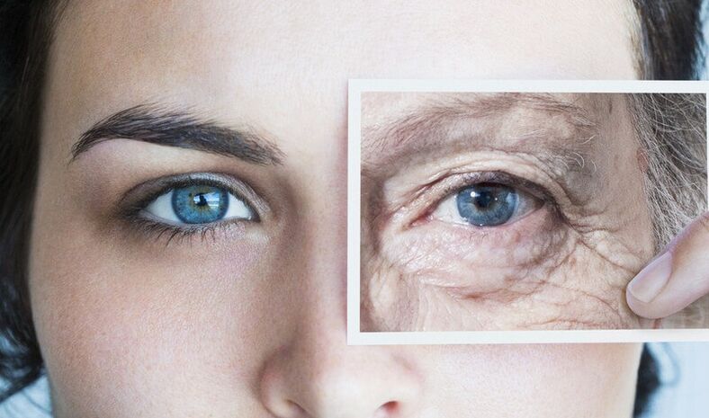 Formas de rejuvenecer la piel alrededor de los ojos.