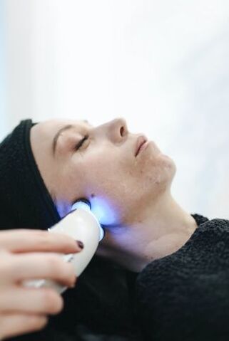Láser de rejuvenecimiento de la piel facial.